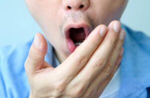 Common Causes of Bad Breath