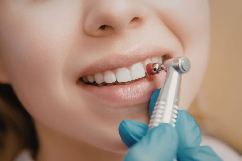 Teeth Cleaning and Checkups