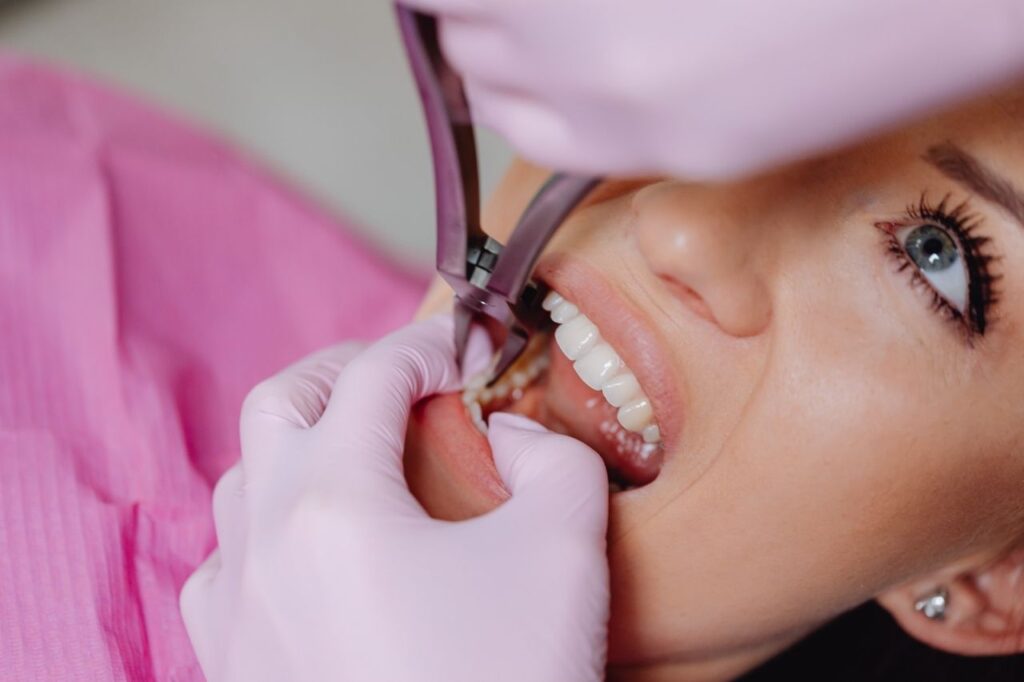 Teeth Cleaning and Checkups