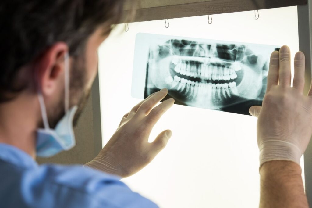 Dental X-Rays