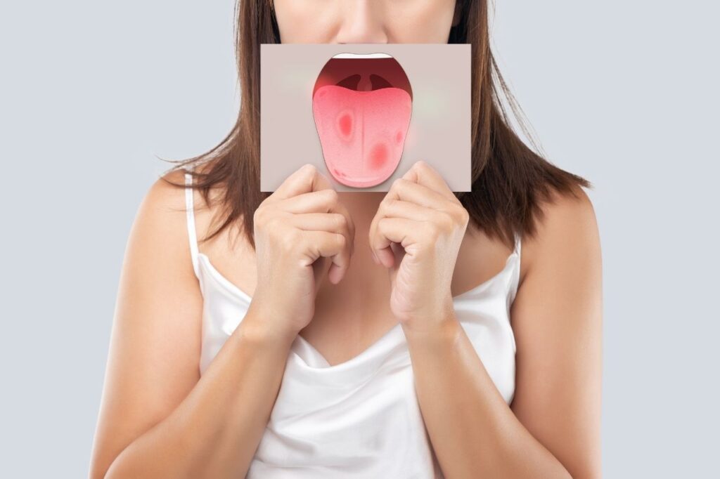 Oral Cancer Screening