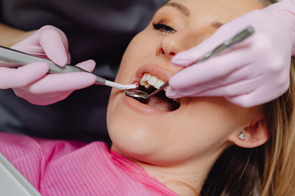 Dental Veneers