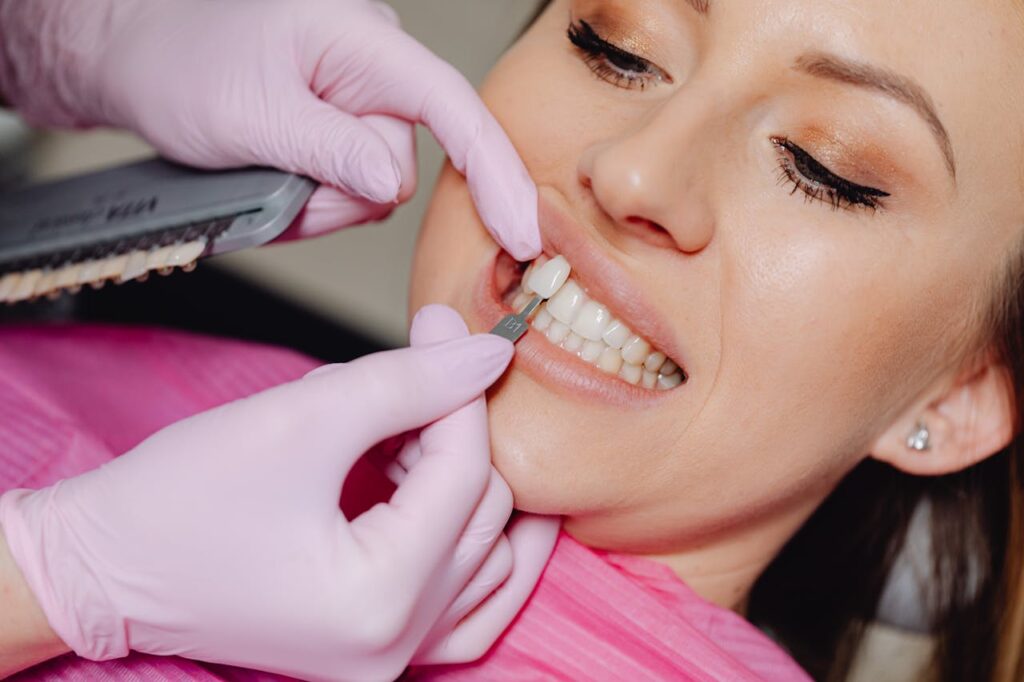 Dental Veneers